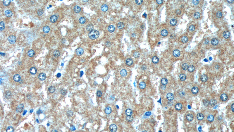 Immunohistochemistry of paraffin-embedded human liver tissue slide using Catalog No:107163(CLTB Antibody) at dilution of 1:200 (under 40x lens).