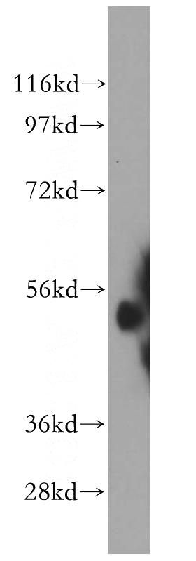 mouse testis tissue were subjected to SDS PAGE followed by western blot with Catalog No:107960(ALDH1A2 antibody) at dilution of 1:500