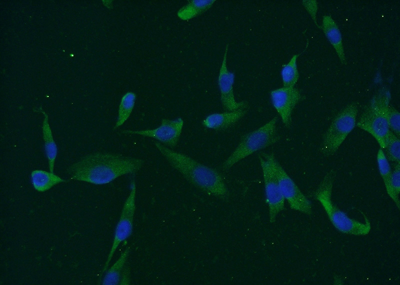 Immunofluorescent analysis of A375 cells using Catalog No:112388(MAGEC3 Antibody) at dilution of 1:50 and Alexa Fluor 488-congugated AffiniPure Goat Anti-Rabbit IgG(H+L)