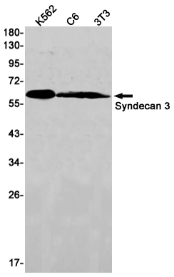 Western blot detection of Syndecan 3 in K562,C6,3T3 cell lysates using Syndecan 3 Rabbit mAb(1:1000 diluted).Predicted band size:46kDa.Observed band size:60kDa.