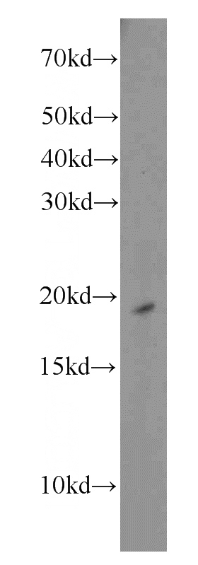 Raji cells were subjected to SDS PAGE followed by western blot with Catalog No:114826(RPS10 antibody) at dilution of 1:1000