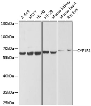 Western blot - CYP1B1 Polyclonal Antibody 