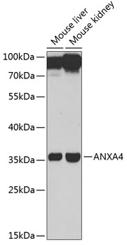 Western blot - ANXA4 Polyclonal Antibody 