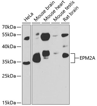 Western blot - EPM2A Polyclonal Antibody 
