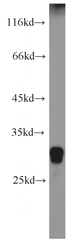 human skeletal muscle tissue were subjected to SDS PAGE followed by western blot with Catalog No:111608(IDI2 antibody) at dilution of 1:2000