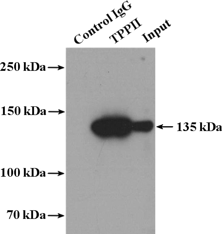 IP Result of anti-TPP2 (IP:Catalog No:116210, 4ug; Detection:Catalog No:107634, 1:500) with Jurkat cells lysate 2400ug.
