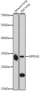Western blot - GPR141 Polyclonal Antibody 