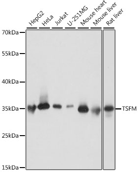 Western blot - TSFM Polyclonal Antibody 