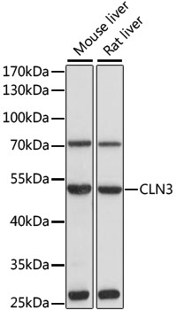 Western blot - CLN3 Polyclonal Antibody 
