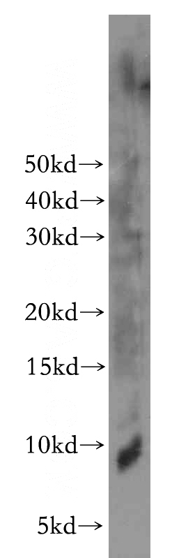 Jurkat cells were subjected to SDS PAGE followed by western blot with Catalog No:110286(ELOF1 antibody) at dilution of 1:500