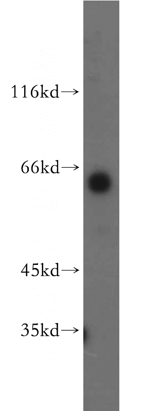 human testis tissue were subjected to SDS PAGE followed by western blot with Catalog No:113915(PIP5K1B antibody) at dilution of 1:500
