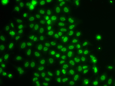 Immunofluorescence - TOX Polyclonal Antibody 