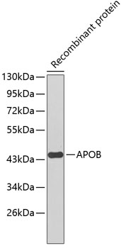 Western blot - APOB Monoclonal Antibody 