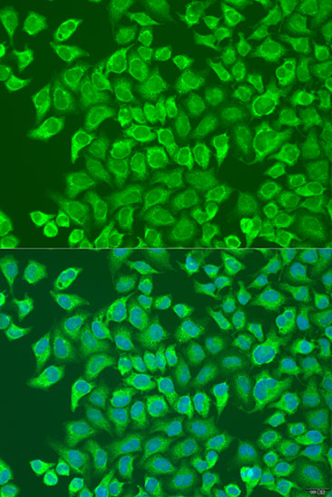 Immunofluorescence - CD79A Polyclonal Antibody 