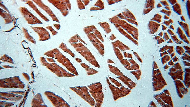 Immunohistochemical of paraffin-embedded human skeletal muscle using Catalog No:115204(SERPINB6 antibody) at dilution of 1:50 (under 10x lens)