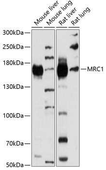 Western blot - MRC1 Polyclonal Antibody 