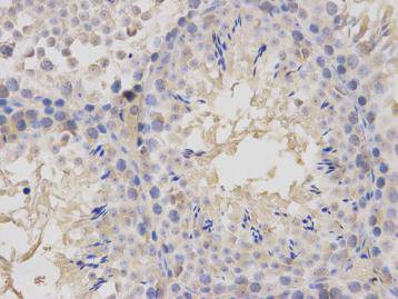 Fig3: Immunohistochemical analysis of paraffin-embedded mouse testis tissue using anti- Geminin rabbit polyclonal antibody.