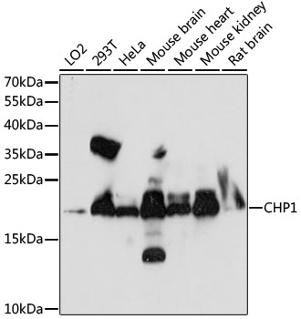Western blot - CHP1 Polyclonal Antibody 