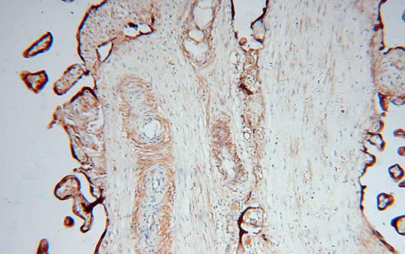 Immunohistochemical of paraffin-embedded human placenta using Catalog No:109596(CSHL1 antibody) at dilution of 1:100 (under 10x lens)