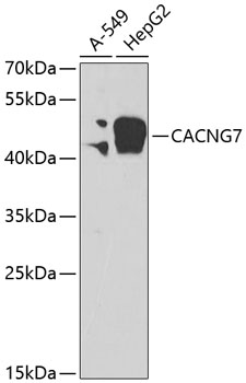 Western blot - CACNG7 Polyclonal Antibody 