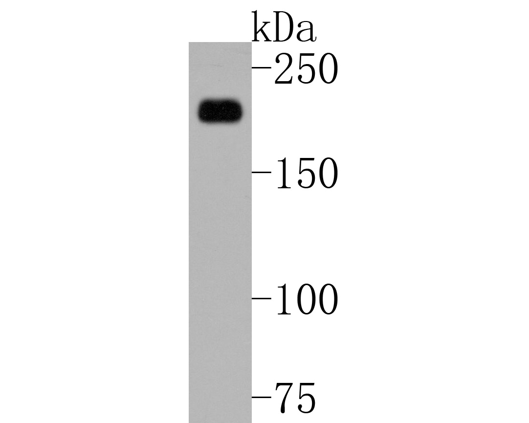 Fig2:; Western blot analysis of Alpha-2-macroglobulin on LO2 cell lysate. Proteins were transferred to a PVDF membrane and blocked with 5% BSA in PBS for 1 hour at room temperature. The primary antibody ( 1/500) was used in 5% BSA at room temperature for 2 hours. Goat Anti-Rabbit IgG - HRP Secondary Antibody (HA1001) at 1:5,000 dilution was used for 1 hour at room temperature.