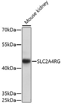 Western blot - SLC2A4RG Polyclonal Antibody 