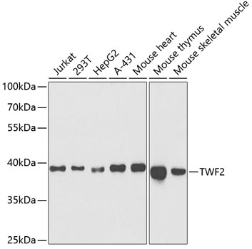 Western blot - TWF2 Polyclonal Antibody 