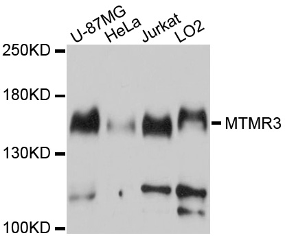 Western blot - MTMR3 Polyclonal Antibody 