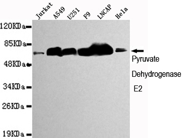 Western blot detection of Pyruvate Dehydrogenase E2 in Jurkat,A549,U251,F9,Lncap and Hela cell lysates using Pyruvate Dehydrogenase E2 mouse mAb (1:1000 diluted).Predicted band size:69KDa.Observed band size:69KDa.