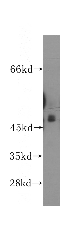 NIH/3T3 cells were subjected to SDS PAGE followed by western blot with Catalog No:108124(AP3M1 antibody) at dilution of 1:400