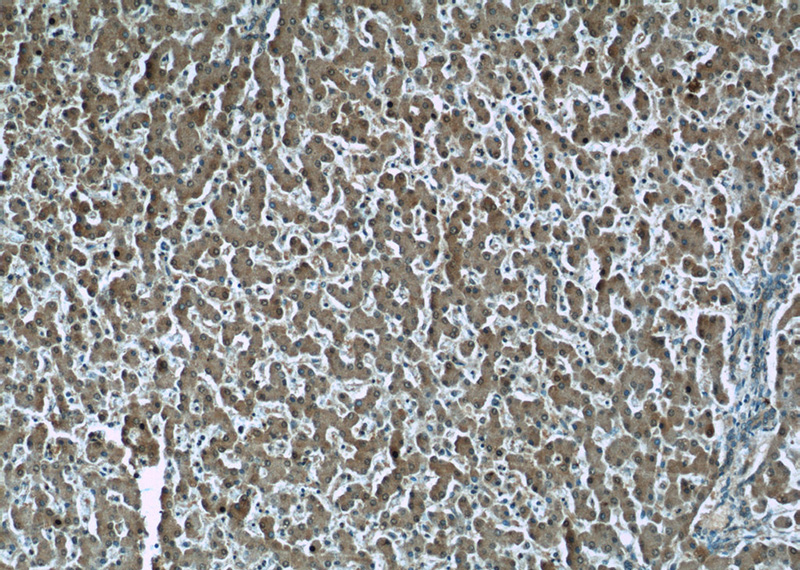 Immunohistochemistry of paraffin-embedded human liver tissue slide using Catalog No:107310(GSTO1 Antibody) at dilution of 1:50