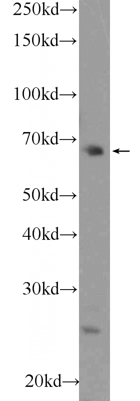 HEK-293 cells were subjected to SDS PAGE followed by western blot with Catalog No:110555(FBXO43 Antibody) at dilution of 1:300