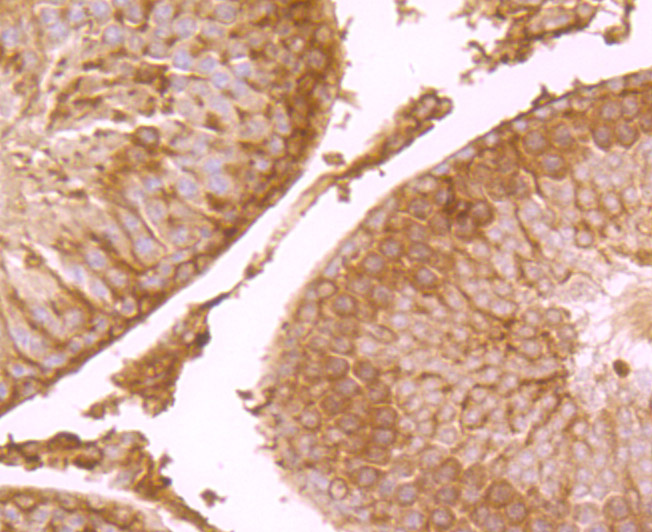 Fig5: Immunohistochemical analysis of paraffin-embedded rat testis tissue using anti-NaV1.7 antibody. Counter stained with hematoxylin.