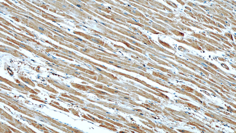 Immunohistochemical of paraffin-embedded human heart using Catalog No:107293(GEFT antibody) at dilution of 1:50 (under 10x lens)