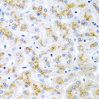 Immunohistochemistry - WNT2 Polyclonal Antibody 