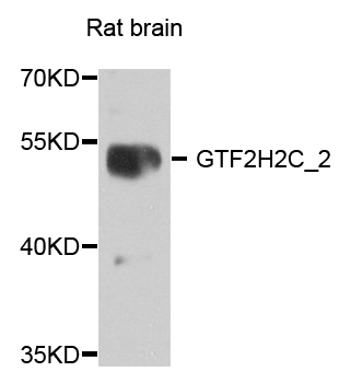 Western blot - GTF2H2C_2 Polyclonal Antibody 