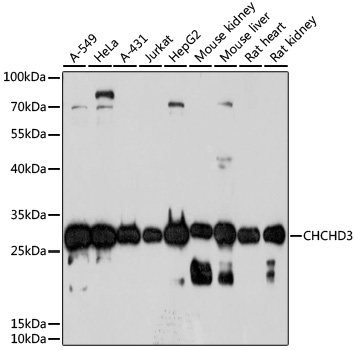 Western blot - CHCHD3 Polyclonal Antibody 