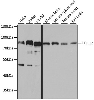 Western blot - TTLL12 Polyclonal Antibody 