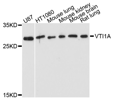 Western blot - VTI1A Polyclonal Antibody 