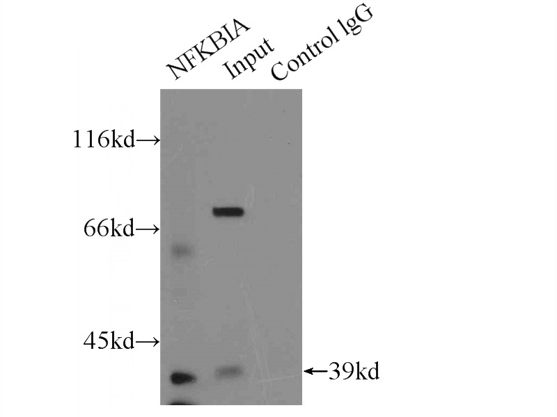 IP Result of anti-NFKBIA (IP:Catalog No:111641, 5ug; Detection:Catalog No:111641 1:500) with HeLa cells lysate 2000ug.