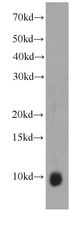 HeLa cells were subjected to SDS PAGE followed by western blot with Catalog No:107519(S100A6 antibody) at dilution of 1:1000