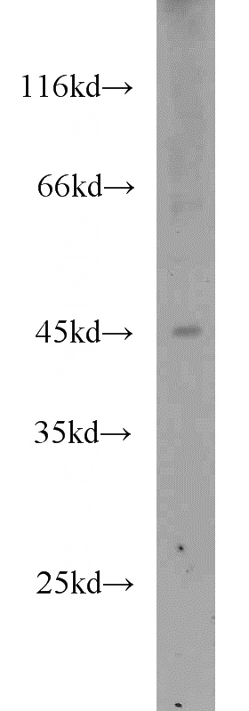 HEK-293 cells were subjected to SDS PAGE followed by western blot with Catalog No:116254(TOR3A antibody) at dilution of 1:300
