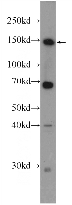 mouse liver tissue were subjected to SDS PAGE followed by western blot with Catalog No:116909(ZBTB11 Antibody) at dilution of 1:600