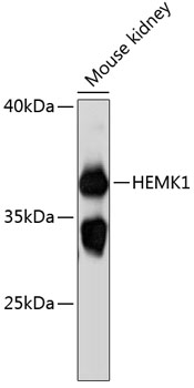 Western blot - HEMK1 Polyclonal Antibody 