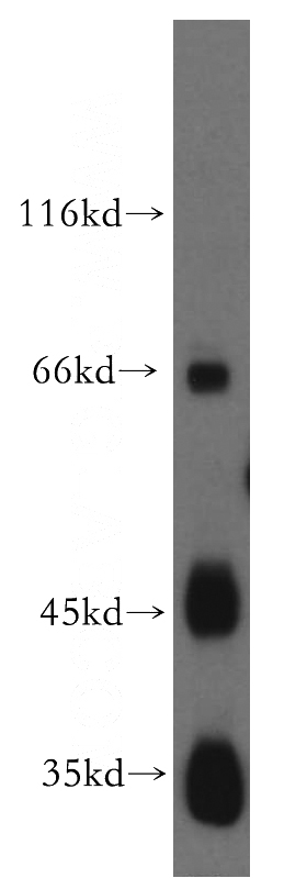 human placenta tissue were subjected to SDS PAGE followed by western blot with Catalog No:111882(JAM2 antibody) at dilution of 1:300