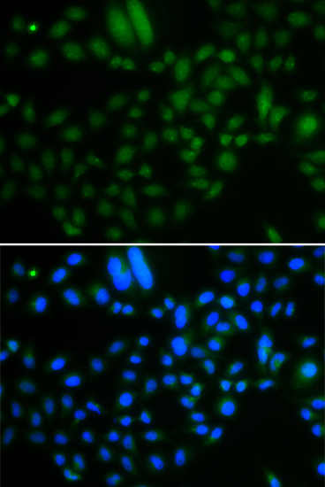 Immunofluorescence - ALKBH8 Polyclonal Antibody 