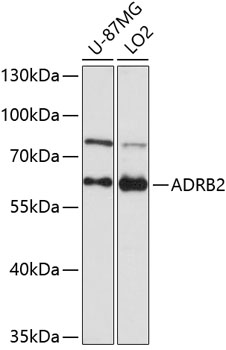 Western blot - ADRB2 Polyclonal Antibody 