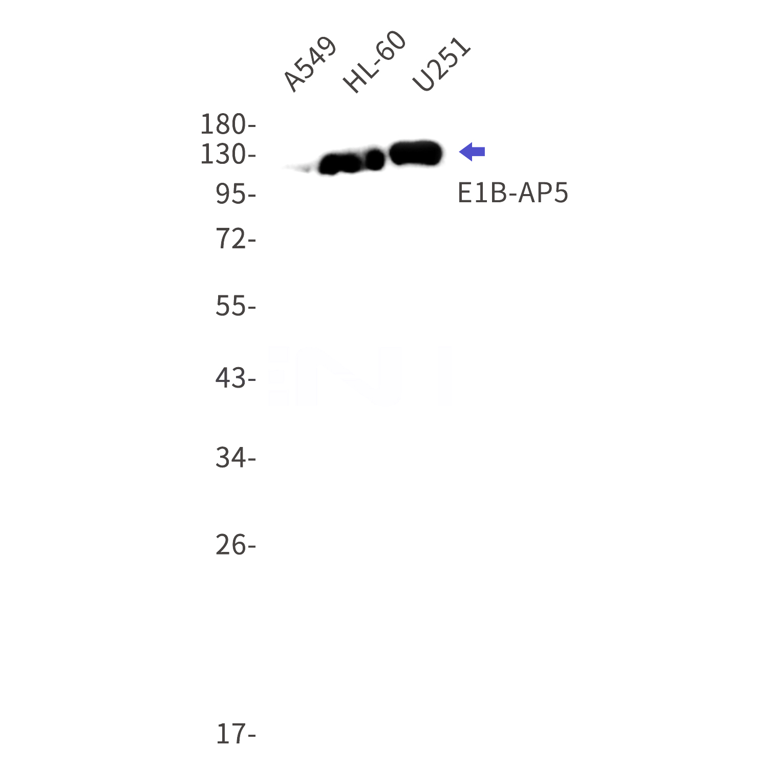 Western blot detection of E1B-AP5 in A549,HL-60,U251 cell lysates using E1B-AP5 Rabbit mAb(1:1000 diluted).Predicted band size:96kDa.Observed band size:118kDa.