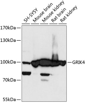 Western blot - GRIK4 Polyclonal Antibody 