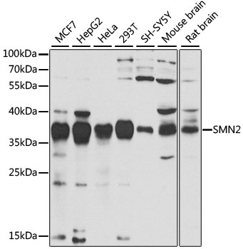 Western blot - SMN2 Polyclonal Antibody 